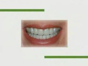 ODONTOLOGIA ESTETICA E INTEGRAL, DR. ARTURO BARROS DE CIMA